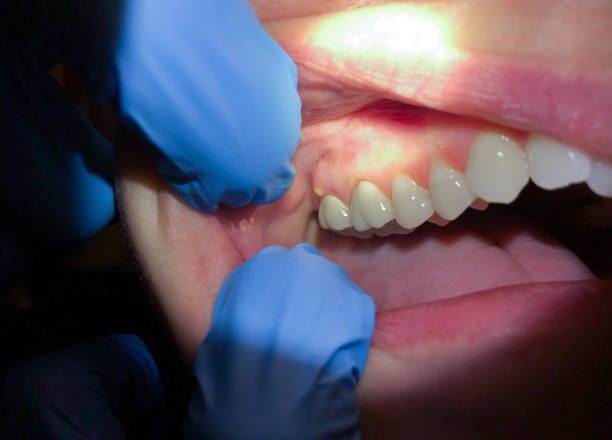 Best Weekend Emergency Dentist in Middletown, VA